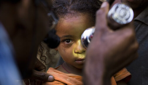 A young child has their eyes examined with a torch.