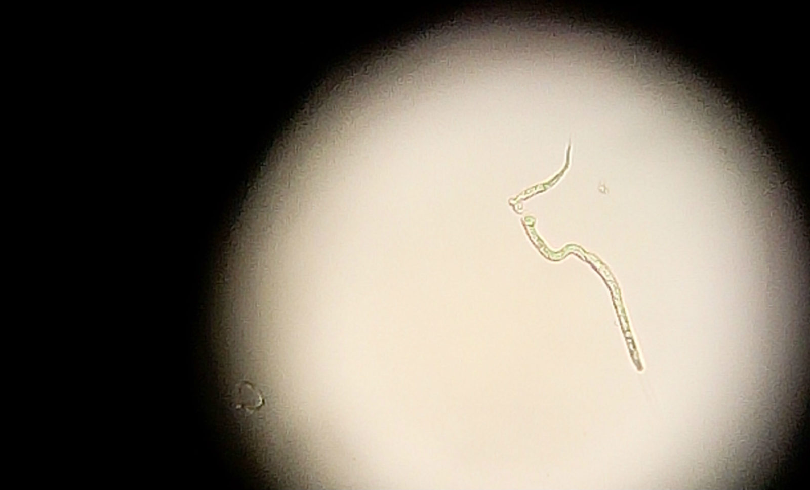 Microscopic parasite