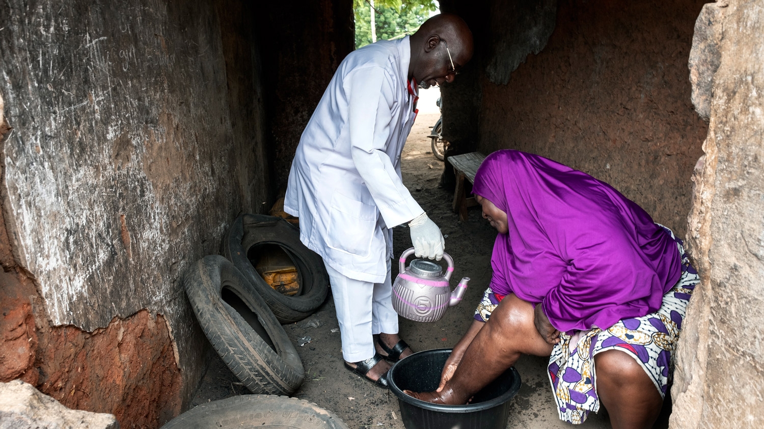 A health worker helps a woman wash her leg, which has been affected by lymphoedema.